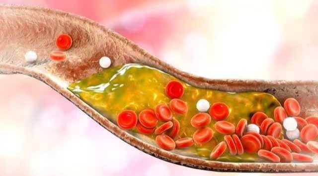 sorlife納豆激酶-養護你的血管，守護身體年輕態