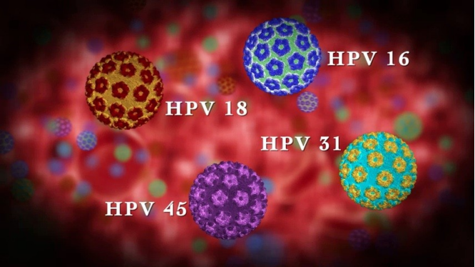 Sorlife：染上HPV別害怕! 提高自身免疫力，消滅病毒有方法。